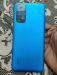 Redmi not 11